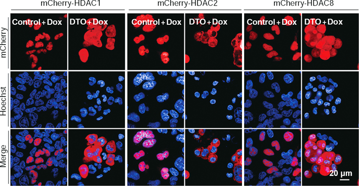 Role of Nuclear Import Pathway in Epigenetic Silencing Identified